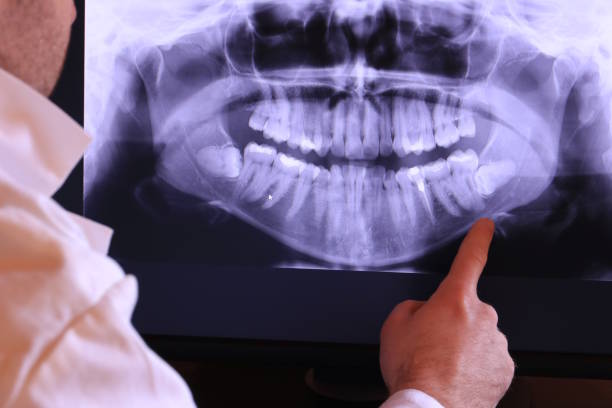 Best Dental Abscess Treatment in Willow, AK